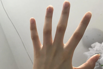 女性手背青筋明显命苦吗